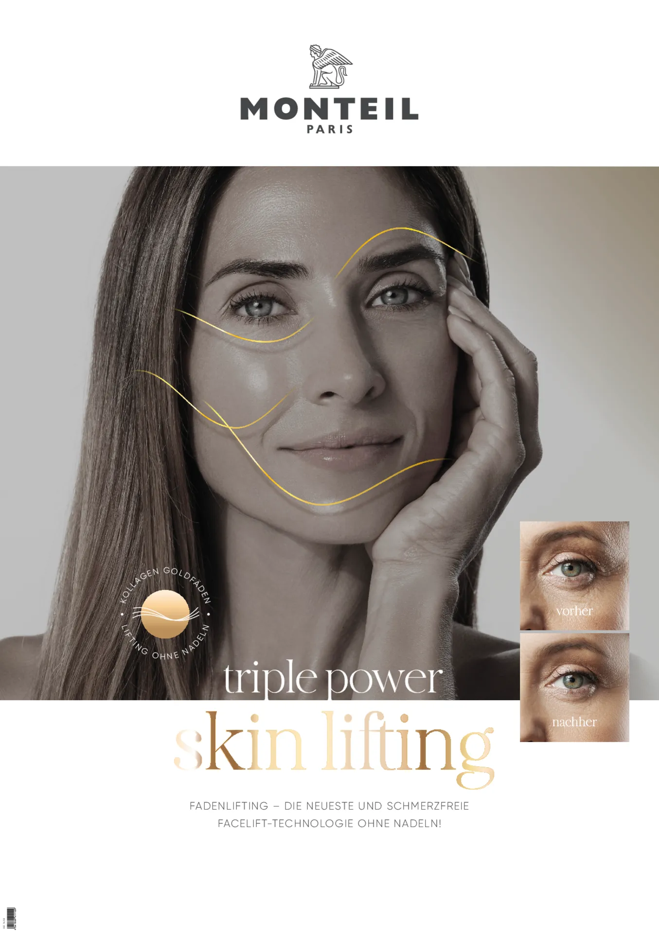 FADENLIFTING Poster, DIN A1